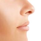 Rhinoplasty